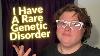 Life With A Rare Genetic Disorder Ep 1
